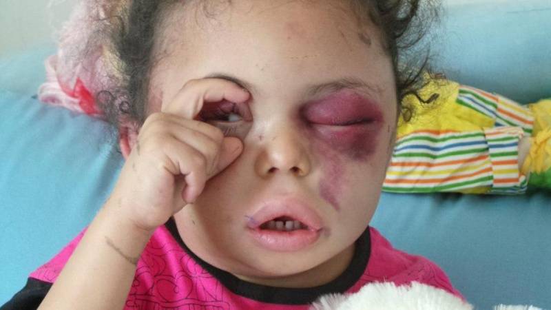 یمنی بچی کی ویڈیو اور تصاویر نے پوری دنیا میں تہلکہ مچا دیا