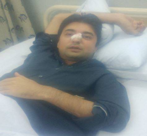 وزیر مملکت مراد سعید پاؤں پھسلنے سے گر کر زخمی ہوگئے