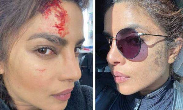 بھارتی اداکارہ پریانکا چوپڑا زخمی ۔۔۔ ؟ 