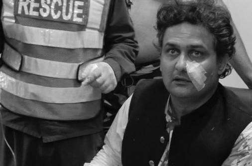 کنٹینر پر فائرنگ، فیصل جاوید خان زخمی، تصویر سوشل میڈیا پر وائرل